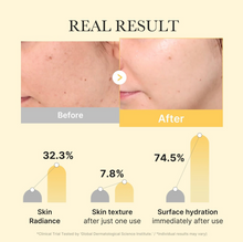 Load image into Gallery viewer, MEDICUBE Kojic Acid Turmeric Brightening Gel Mask