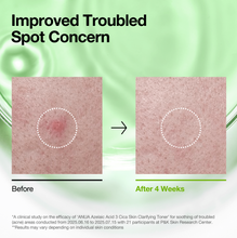 Load image into Gallery viewer, ANUA Azelaic 3 Cica Skin Clarifying Toner 250ml