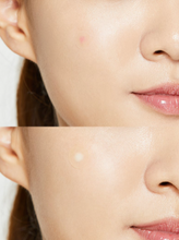 Cargar imagen en el visor de la galería, COSRX PIMPLE MASTER PATCHES (24)